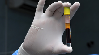 How Long Could Covid-19 Immunity Last? It's Not Just About Antibodies